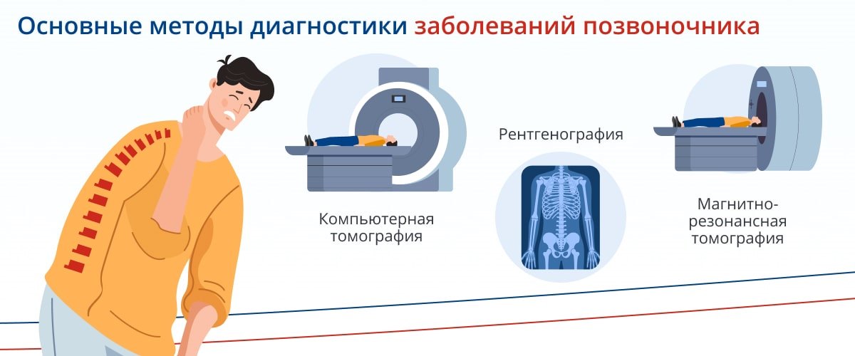 Межпозвонковая грыжа шейного отдела - 1