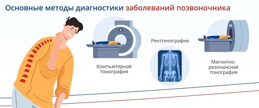 Искривление позвоночника - 4