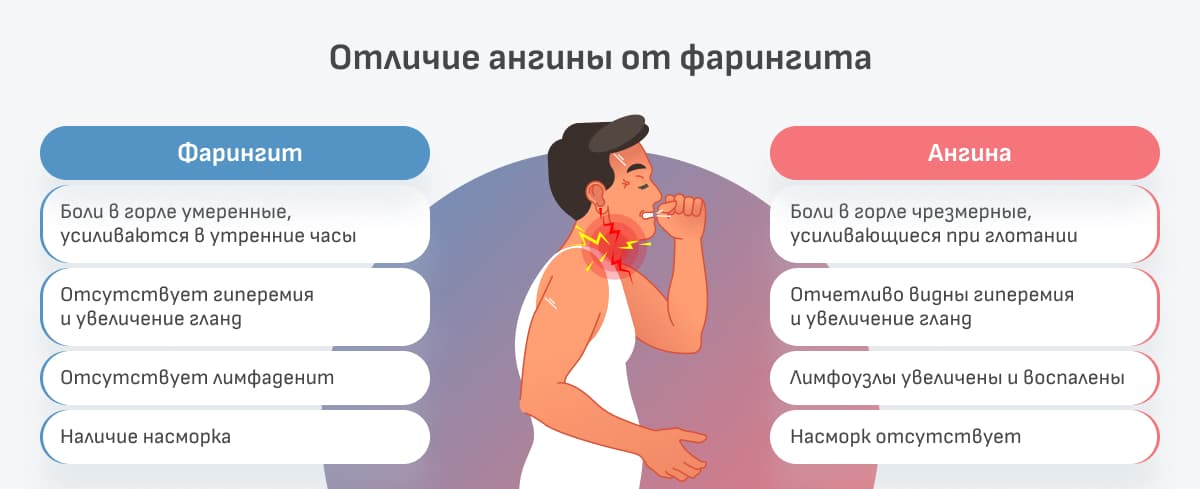 Фарингит, причины и методы лечения