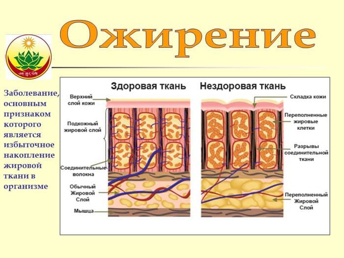 Тибетская медицина против ожирения - 4